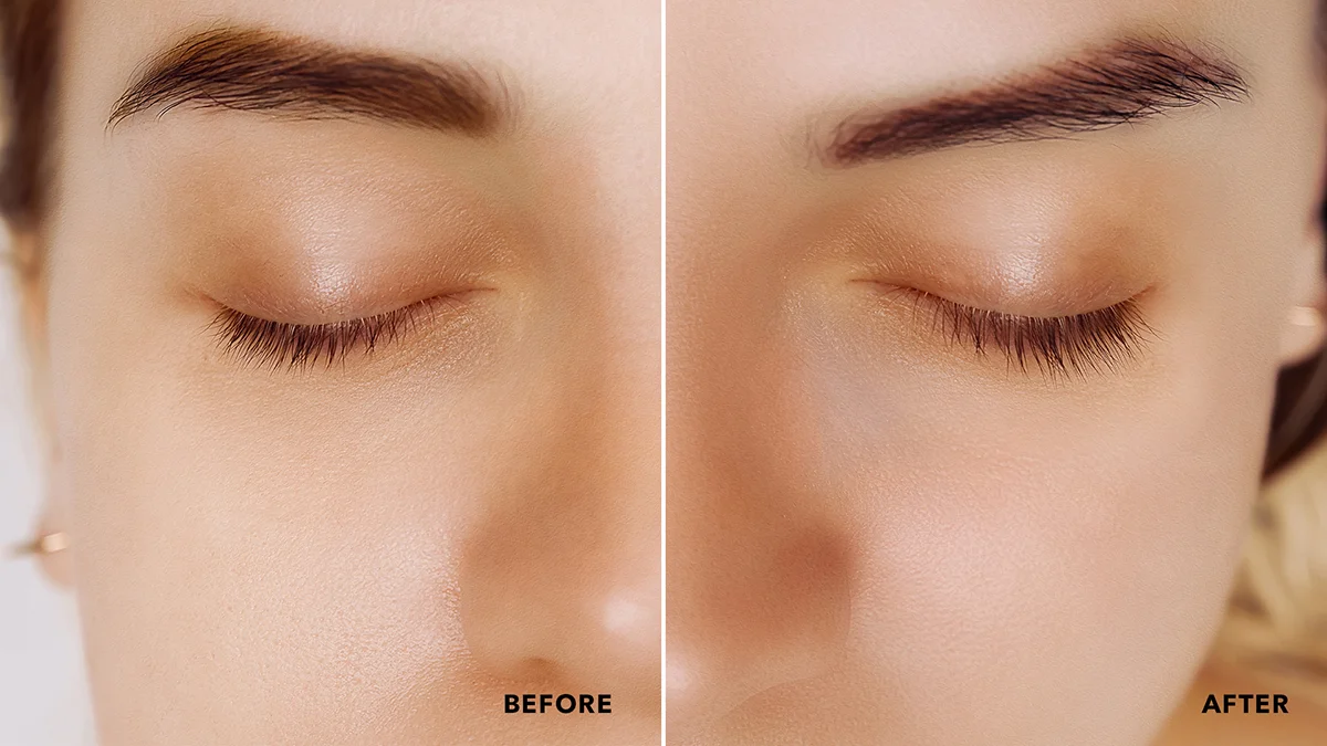 IRIS best eyelash serum without prostaglandin before & after